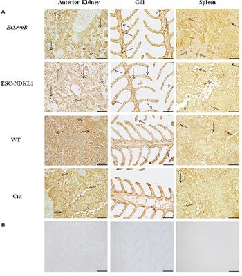 Assessment of the Live Attenuated and Wild-Type Edwardsiella ictaluri-Induced Immune Gene Expression and Langerhans-Like Cell Profiles in the Immune-Related Organs of Catfish